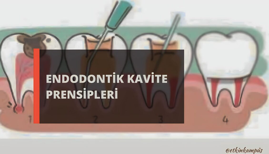 Görselde endodontik kvite prensipleri yazmakta. Arka planda ise çizim diş simgeleri