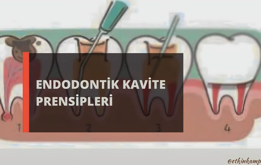 Görselde endodontik kvite prensipleri yazmakta. Arka planda ise çizim diş simgeleri