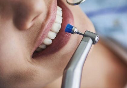 bir kadının dişlerinde tedavi yapılmakta
