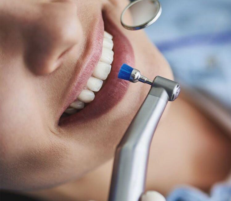 bir kadının dişlerinde tedavi yapılmakta