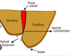 Endodontide Çalışma Boyu Belirleme Yöntemleri Kimyasal ve mekanik olarak konforlu bir preperasyon ve sızdırmaz kök kanal dolgusunun yapılabilmesi için kök kanal çalışma boyunun doğru belirlenmesi gerekir.Kök kanal çalışma boyu nedir ?, kök kanal çalışma boyu koronalden seçilen referans noktasından kanalın şekillenip doldurulacağı noktaya olan mesafesidir.Kök kanal preperasyonu için kilit nokta minör apikal foramendir. Yani bitim noktası minör apikal foramen olarak kabul edilir.Minör apikal foramen ; kök pulpasının periodontal alanla birleştiği sınır olarak kabul edilir. Anatomik apeksten 0-2mm içerde yer alabileceği gösterilmiştir.Apikal foramen dişin anatomik apeksi ile aynı doğrultuda yer almaz.Yani asimetrik bir durum mevcut olabilir. Bu noktayı belirlemek tedavi başarısı için oldukça önemlidir. Endodontik tedavide uygulanan eğeleme, dezenfeksiyon ve tıkama işlemlerinin apikal foramende noktalanması başarının tedavisine oldukça olumlu etkileri görülmektedir .Kök kanal boyundan uzun alıştığınız durumda geniş yara yüzeyi meydana getirme olasılığımız artmaktadır .Aslında oluşacak tek sorun geniş yara yüzeyi oluşturmak değil; kanal içi debris, enfekte doku artıkları, irriganlar ve kanal dolgu maddelerinin periapikal dokulara taşmasıyla beraber tedavinin başarı oranı oldukça düşecektir .Kök kanal tıkaması, kanal boyundan kısa olması durumunda kanallarda yeteri kadar tıkama ve temizleme yapılmamaktadır. Kanalın apikalinde kalan boşluklar bakterilerin yaşaması ve çoğalması için uygun bir barınak oluştururken, kanal içine sızabilecek doku sıvıları bu mikroorganizmaların besin ihtiyacını karşılayabilmektedir. Kanalda tıkama yapılırken (özellikle enfekte vakalarda) kanalın apikal 3mm’nin iyi temizlenip doldurulması büyük önem taşımaktadır. 