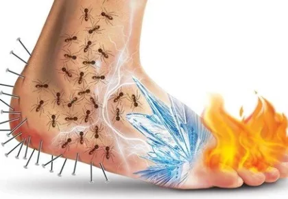 bir ayak çizimi. Ayağın topuk yerlerinde çiviler, bilek kısımlarında karıncalar, tarak kısımlarında kırık hissi ve parmak uçlarında ateş hissi resmedilmiş.