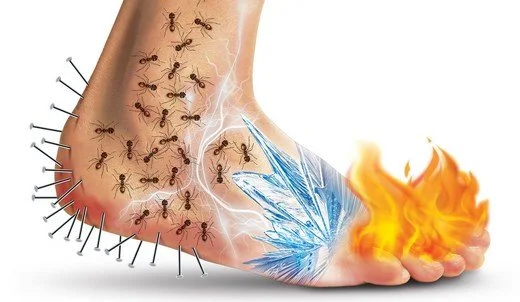 bir ayak çizimi. Ayağın topuk yerlerinde çiviler, bilek kısımlarında karıncalar, tarak kısımlarında kırık hissi ve parmak uçlarında ateş hissi resmedilmiş.