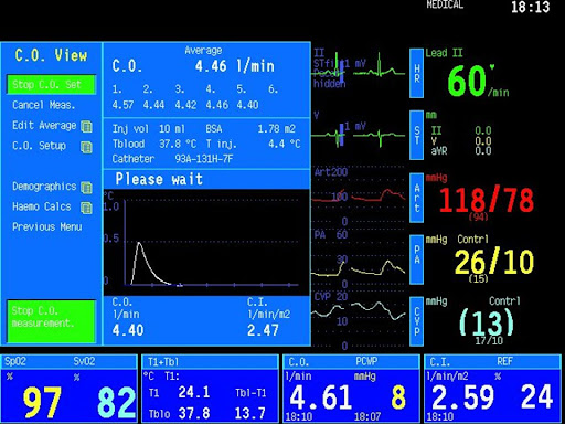 Kritik hastalıklar için kullanım sağlayan Hemodinamik Monitörizasyon’un ekranı.